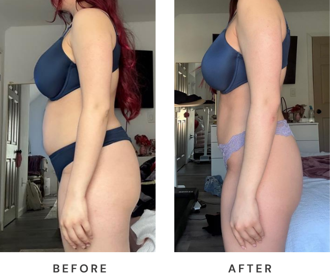 Client before and after side profile transformation